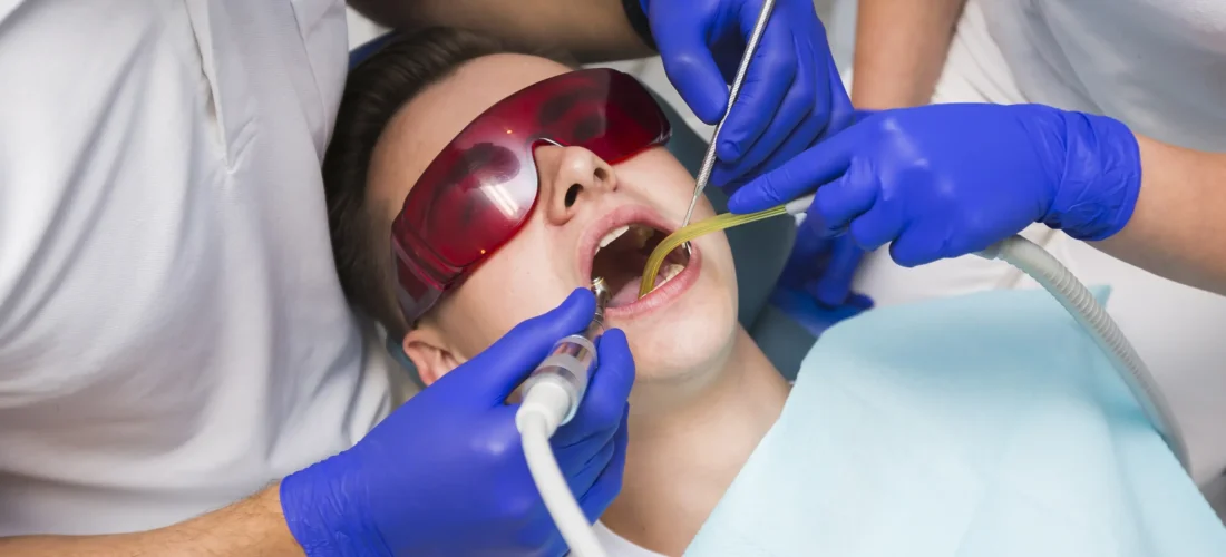 Root canal treatment